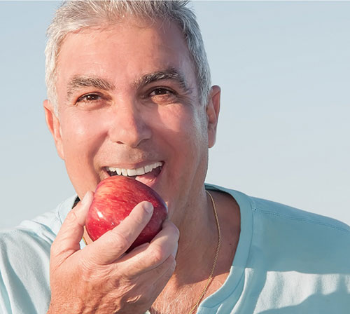 Advantages of Dental Implants