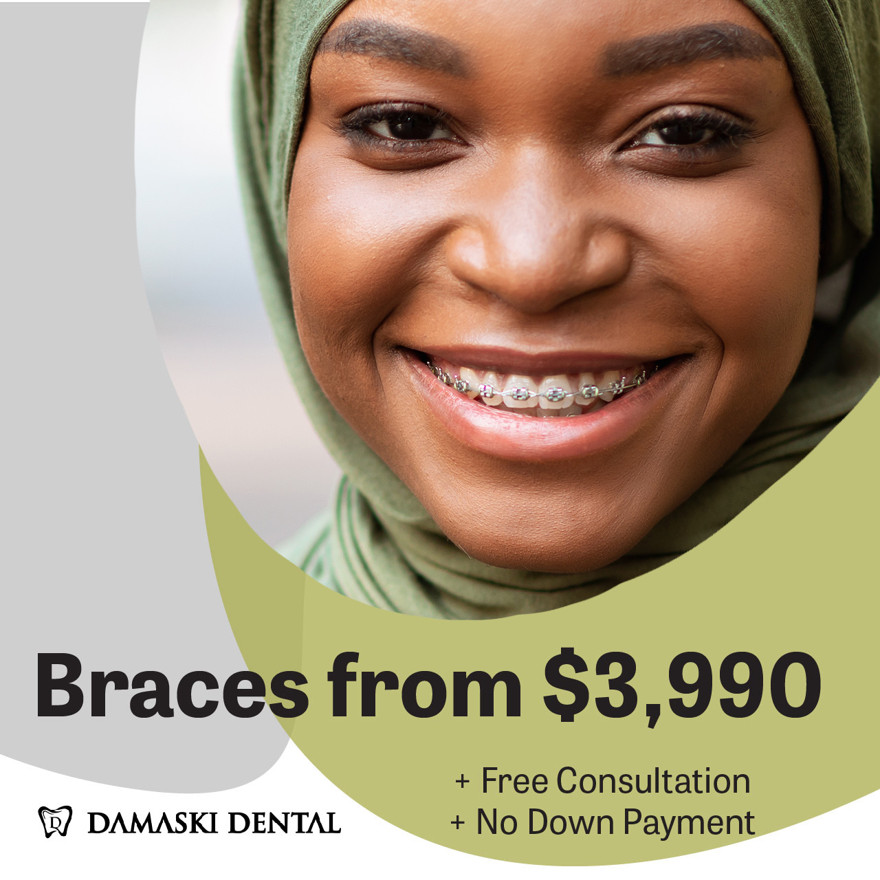 Dental Braces - Damaski Dental Centre - Dentist Mississauga