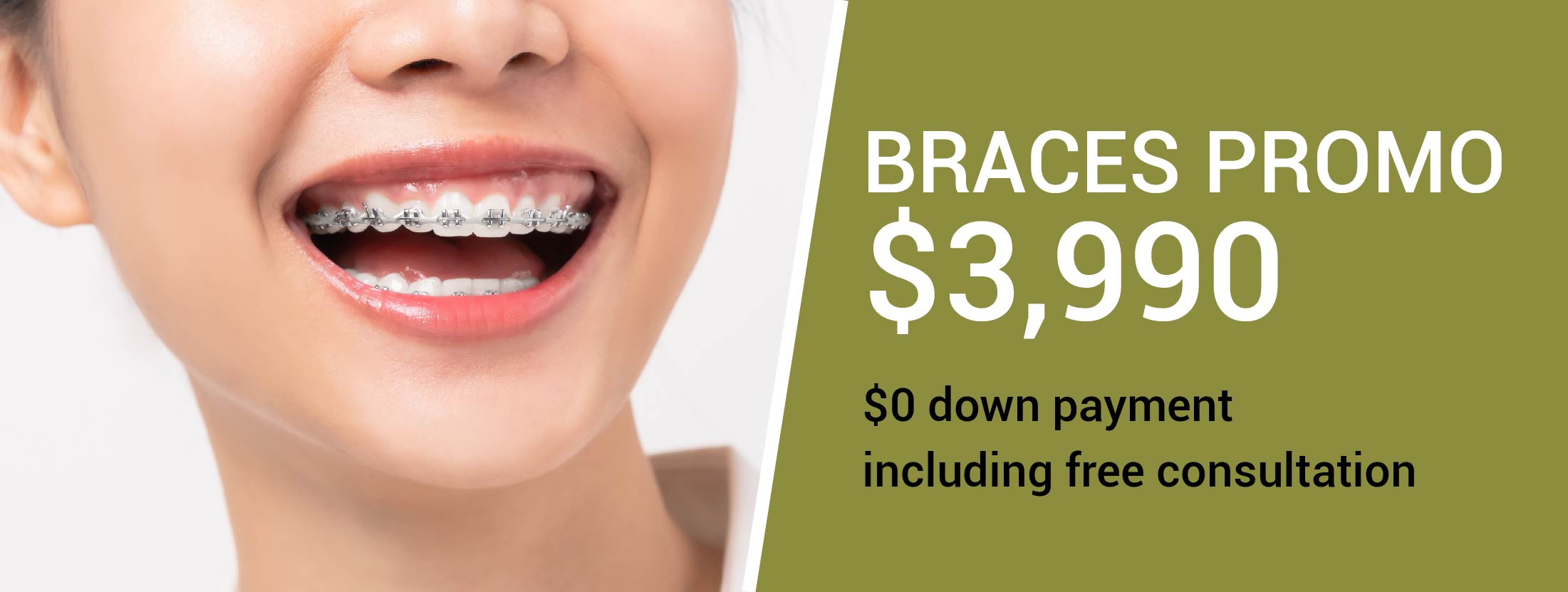 dental braces promotion in mississauga