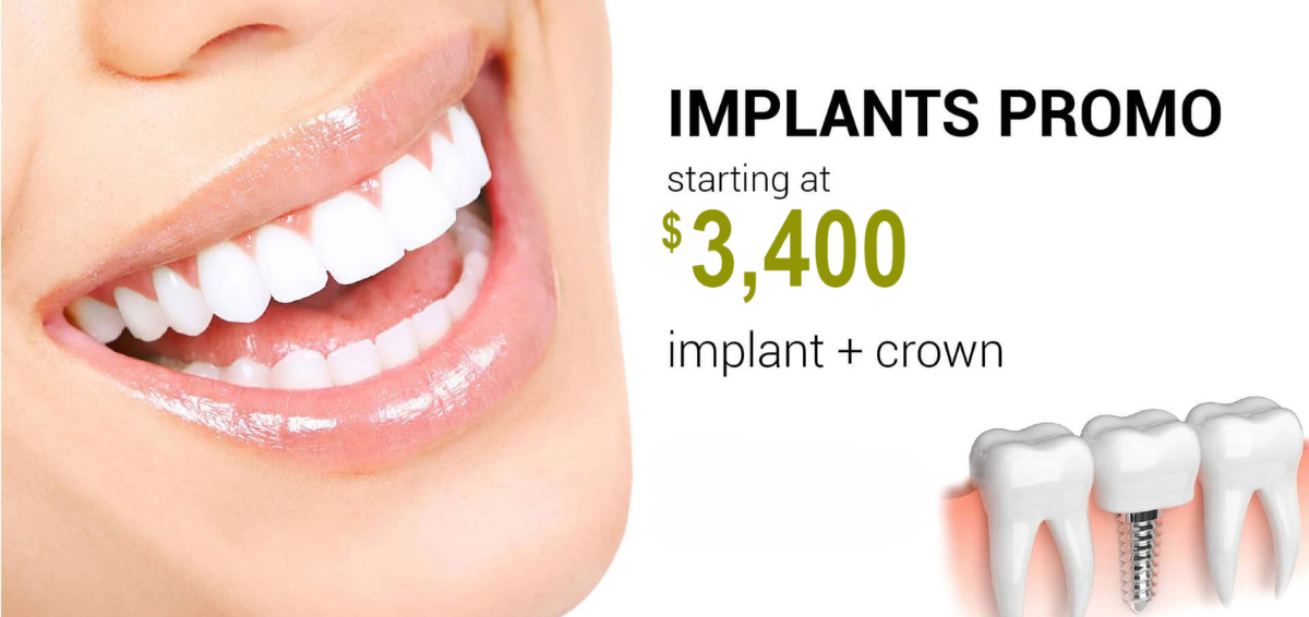 Close-up of a smiling person with white teeth. Text on the right reads: 'IMPLANTS PROMO starting at $3,400 implant + crown, includes free consultation.' Tooth implant graphic below text.