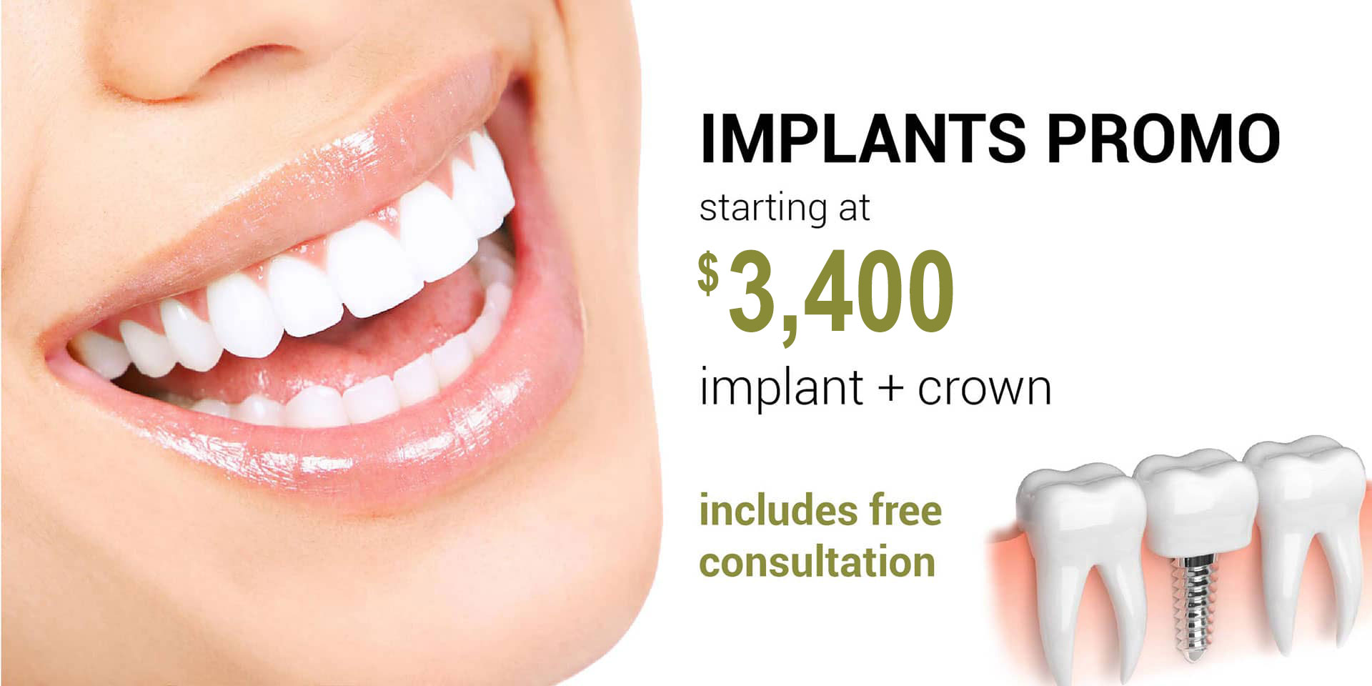 Implant Promo - Includes Free Consultation
